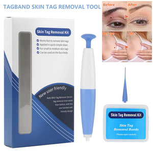 Skin Tag Removal Kit with pen and removal bands for painless home use on face and body skin tags.