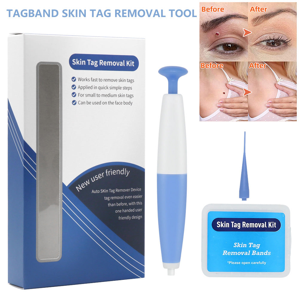 Skin Tag Removal Kit with pen and removal bands for painless home use on face and body skin tags.