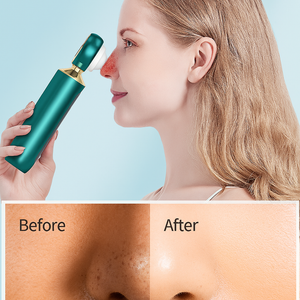 Portable visual blackhead remover with USB recharge, blue light therapy, and magnifying glass for deep pore cleansing and clearer skin.